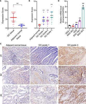 Knockdown of Kremen2 Inhibits Tumor Growth and Migration in Gastric Cancer